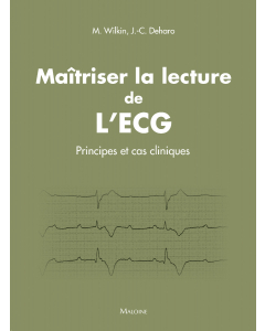 Maîtriser la lecture de l'ECG : Principes et cas cliniques